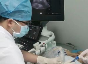 我院成功开展首例超声引导下心包穿刺置管引流术