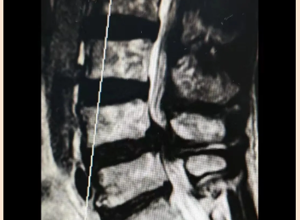 骨外科三区：以精湛医技与人文关怀铸就患者健康防线