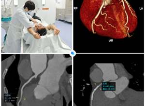 【健康科普】防“猝”于未然，从“心”筛查开始 | 双源CT冠状动脉造影，筑起心脏健康防线